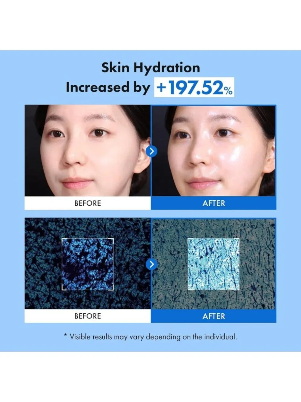 Hydrating Hyaluron Serum with Niacinamide & Glycerin for Plump Glass Skin, 150ml